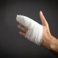 Dłoń z zabandażowanym palcem, który mógł ulec wybiciu. Objawy takiego urazu mogą być bolesne.