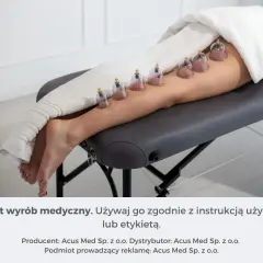 Zabieg stawiania baniek na kolanie. Kilka baniek próżniowych umieszczonych na łydce i udzie.