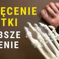 Jak skutecznie zabandażować skręconą kostkę i przyspieszyć gojenie