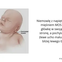 Rozpoznaj naciągnięcie mięśni karku u niemowlaka: najważniejsze objawy