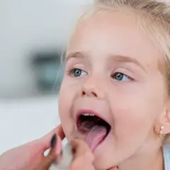 Mononukleoza u dzieci objawy – na co zwrócić uwagę i jak leczyć?