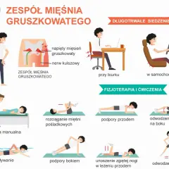 Ilustracja pokazuje zespół mięśnia gruszkowatego i sposoby, jak pozbyć się bólu mięśnia gruszkowatego: ćwiczenia, terapia manualna, pływanie.