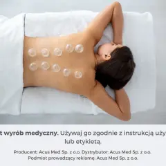 Kobieta z bańkami na plecach. Dowiedz się, jak stawiać bańki ogniowe, by poczuć ulgę.