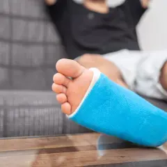 Niebieski gips na nodze, która odczuwa ból kostki po wewnętrznej stronie.