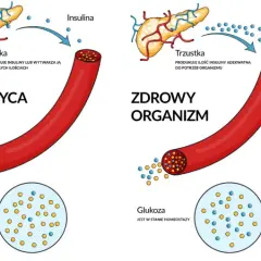 Skąd się bierze cukrzyca? Poznaj zaskakujące przyczyny i czynniki ryzyka