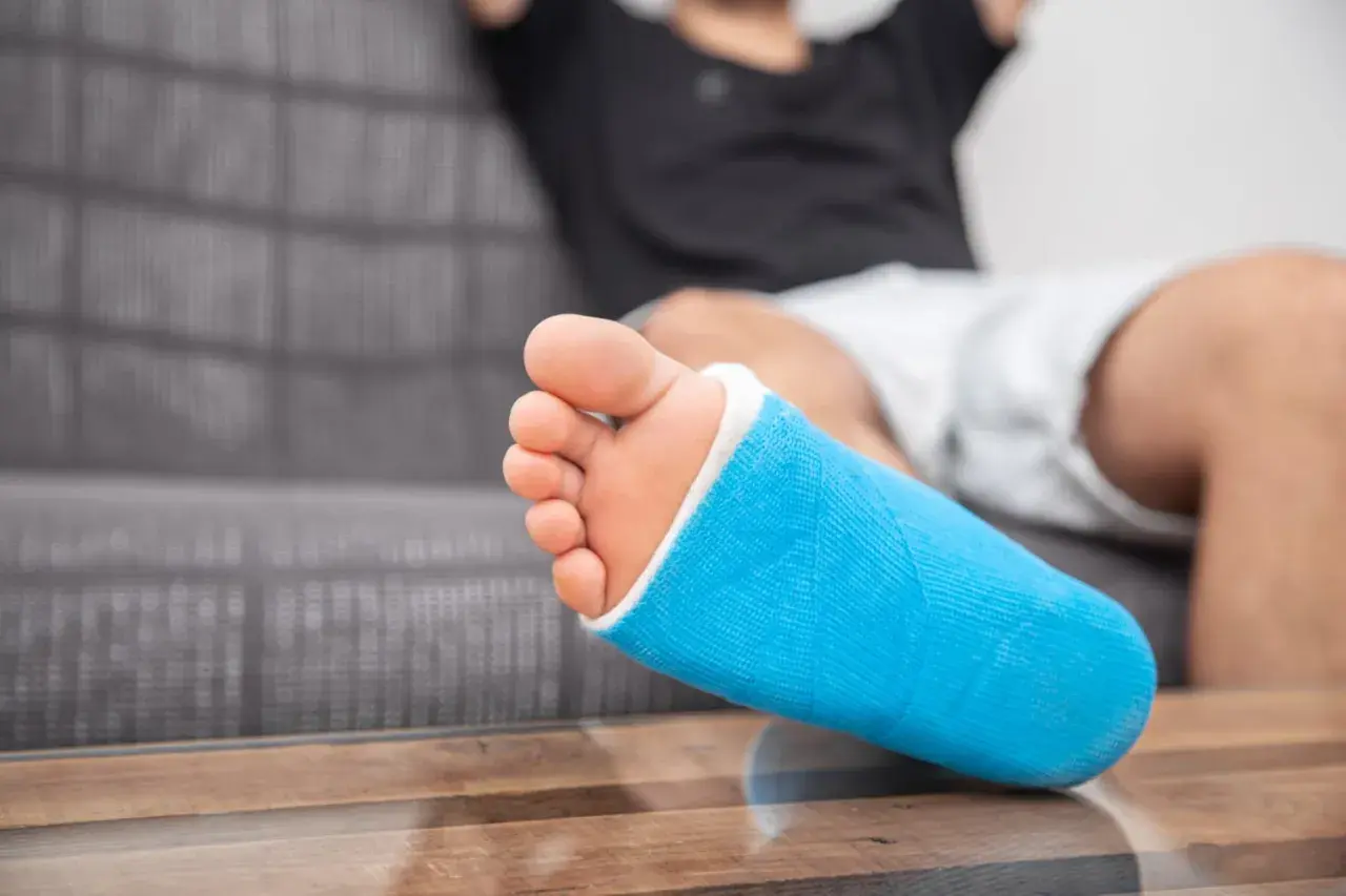 Niebieski gips na nodze, która odczuwa ból kostki po wewnętrznej stronie.