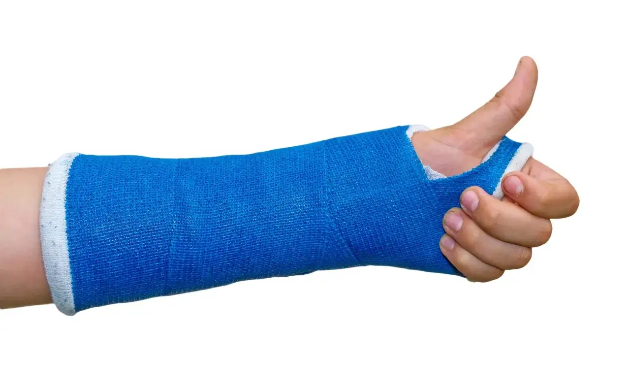 Niebieski gips na ręce po stłuczeniu po upadku. Kciuk wystaje, dając znak
