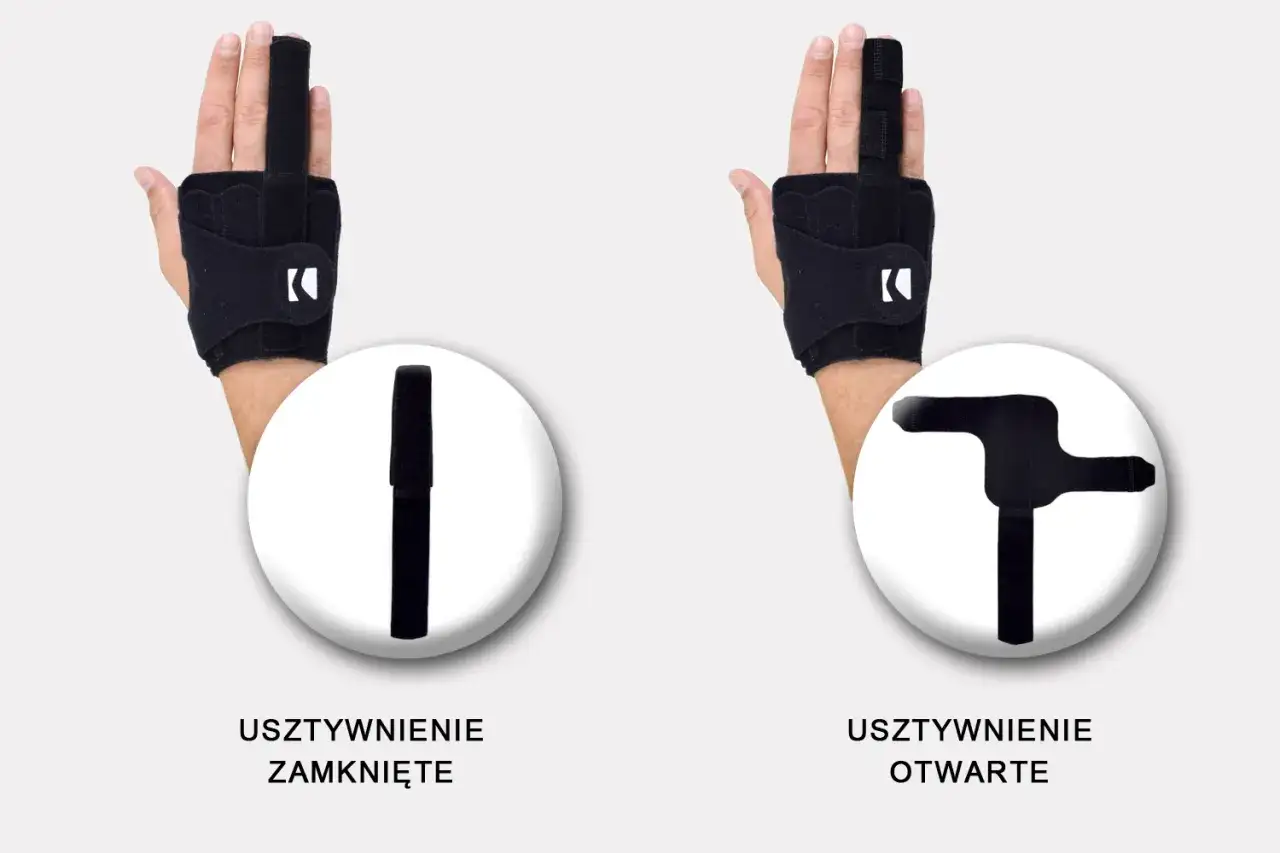 Dwie opcje usztywnienia palca u ręki: zamknięte i otwarte. Ortezy stabilizują palec, pomagając w jego leczeniu.