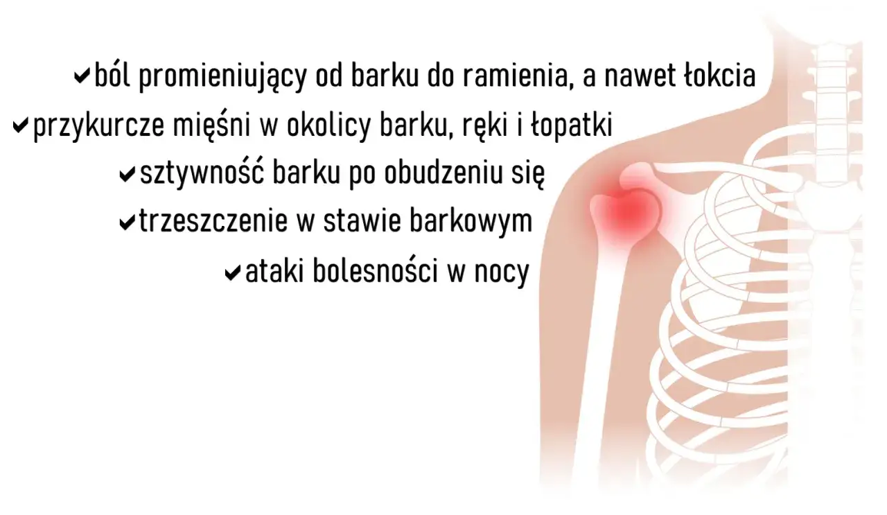 Ilustracja przedstawia objawy artrozy stawu barkowego: ból, przykurcze, sztywność i trzaski.