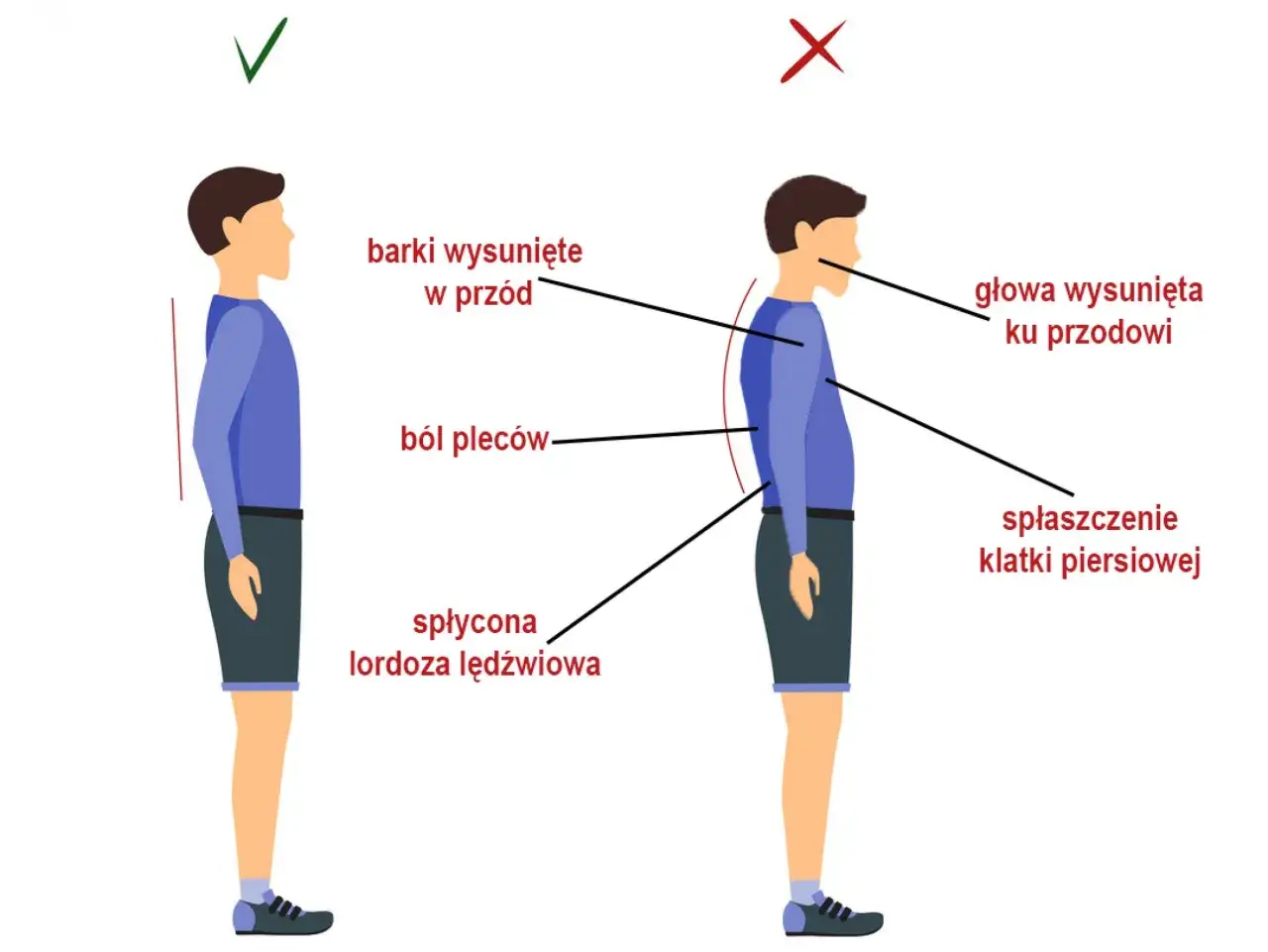 Prawidłowa postawa vs. zła postawa, która może prowadzić do zapalenia mięśni kręgosłupa, bólu pleców i spłaszczenia klatki piersiowej.