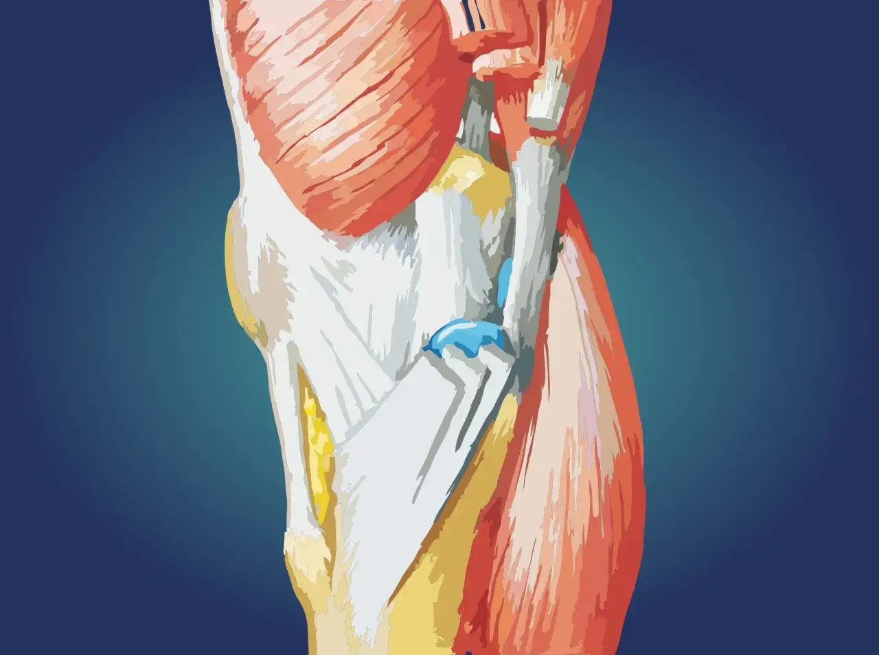 Anatomia kolana z widocznymi mięśniami i ścięgnami, ilustracja może pomóc zrozumieć zapalenie gęsiej stopki.